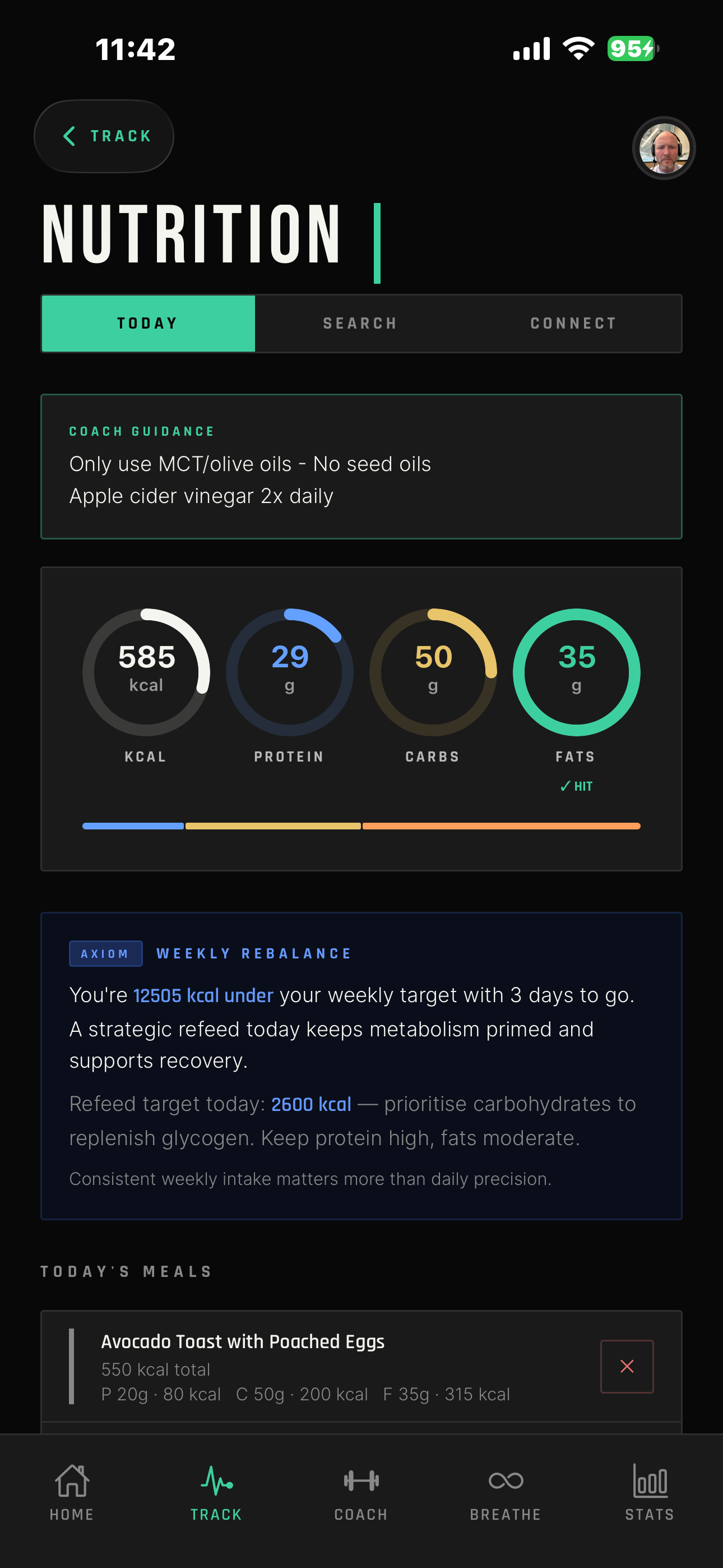 10X-U app — photo-based nutrition tracking